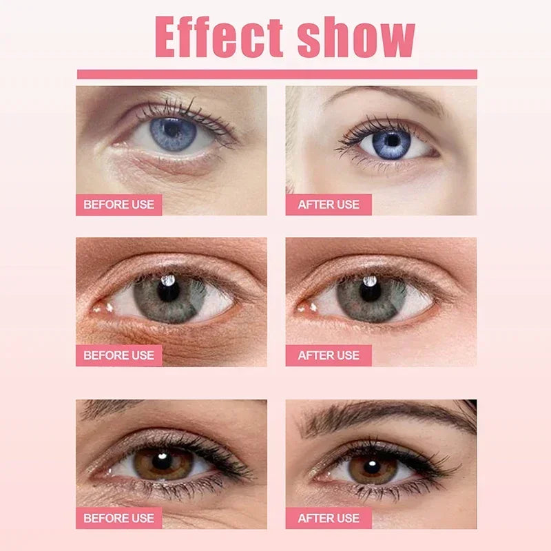 Women Extra Renewing Rosehip Eye Cream For Face Lifting Moisturizing Balm Stick Anti-Puffiness Remove Dark Circle Eye Care 2024