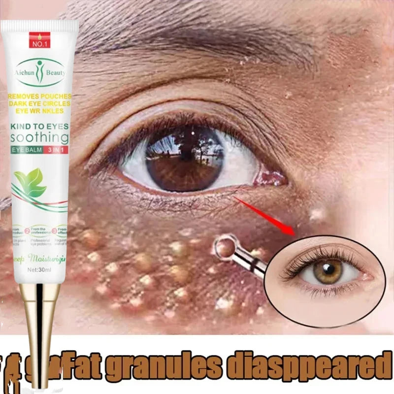 Fat Granules Remover Eye Cream Anti-puffiness Wrinkles Cream Lift Firming Eye Fade Fine Lines Anti-Age Dark Circles Eye Care